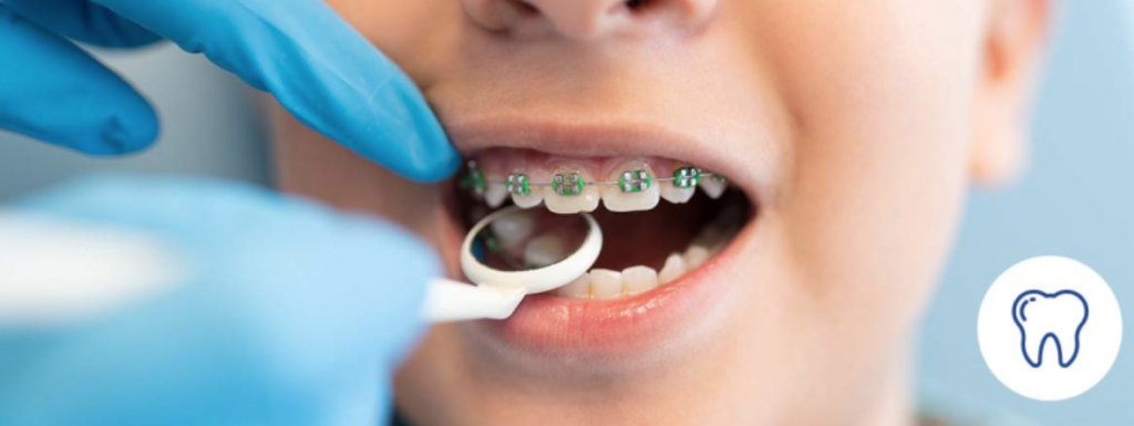 Importancia de que los niños acudan al dentista