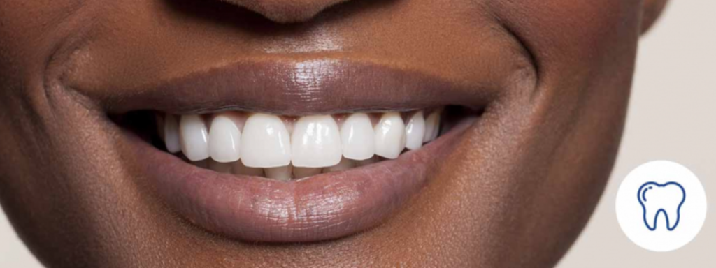 La sonrisa es el verdadero reflejo de su salud